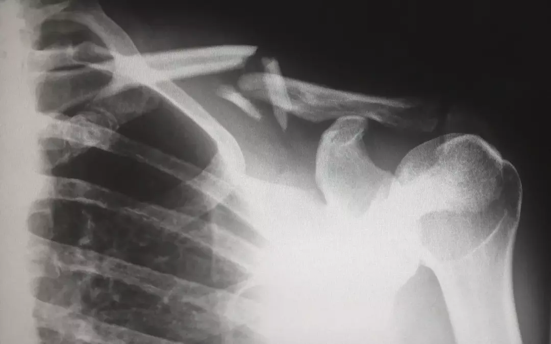 51 röntgenfakta: elektrifierande detaljer om radioaktivitet avslöjat!